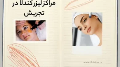 مراکز لیزر کندلا در تجریش