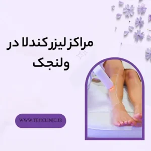 مراکز لیزر کندلا در ولنجک