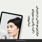 مرکز لیزر مو شاتی در تجریش ( الیت پلاس و سوپرانو تیتانیوم )