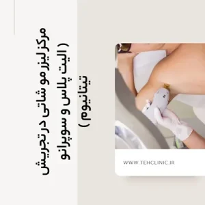 مرکز لیزر مو شاتی در تجریش ( الیت پلاس و سوپرانو تیتانیوم )