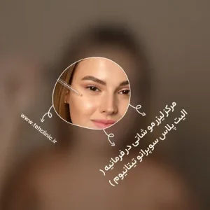 مرکز لیزر مو شاتی در فرمانیه ( الیت پلاس سوپرانو تیتانیوم )