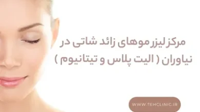 مرکز لیزر موهای زائد شاتی در نیاوران ( الیت پلاس و تیتانیوم )