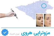 مزوتراپی هروی