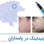 مزونیدلینگ پاسداران