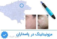 مزونیدلینگ پاسداران