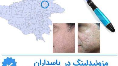 مزونیدلینگ پاسداران