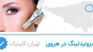 مزونیدلینگ هروی