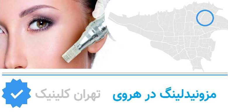 مزونیدلینگ هروی