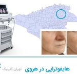 هایفوتراپی در هروی