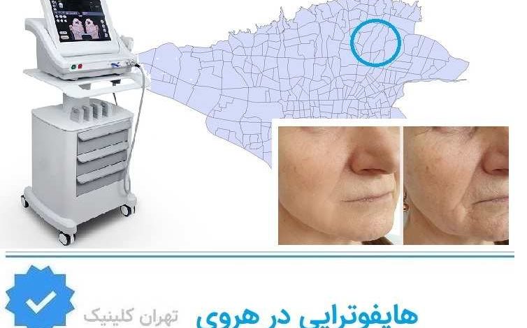 هایفوتراپی در هروی
