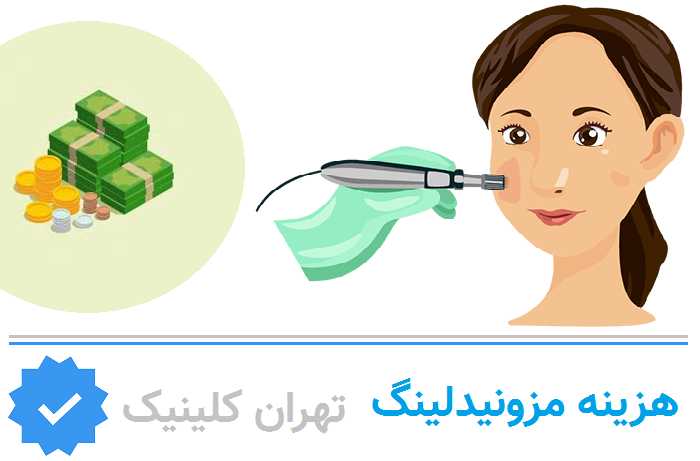 هزینه مزونیدلینگ