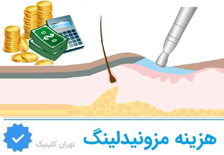 هزینه مزونیدلینگ در پاسداران؛ چرا قیمت واحد منطقی نیست؟