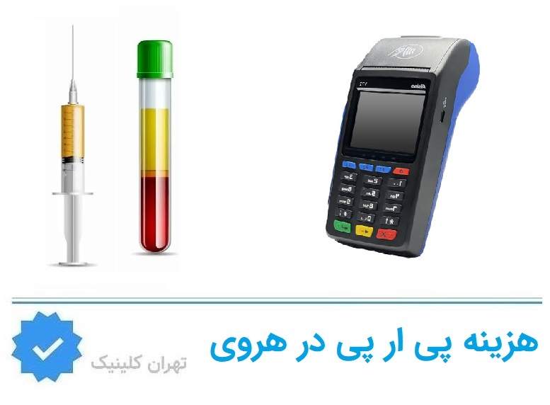 هزینه پی آر پی