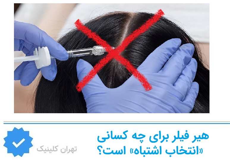 هیر فیلر برای چه کسانی «انتخاب اشتباه» است؟