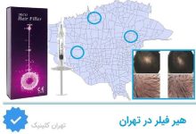 مراکز هیر فیلر تهران