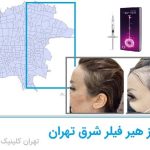 هیر فیلر شرق تهران