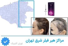 هیر فیلر شرق تهران