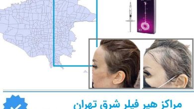هیر فیلر شرق تهران