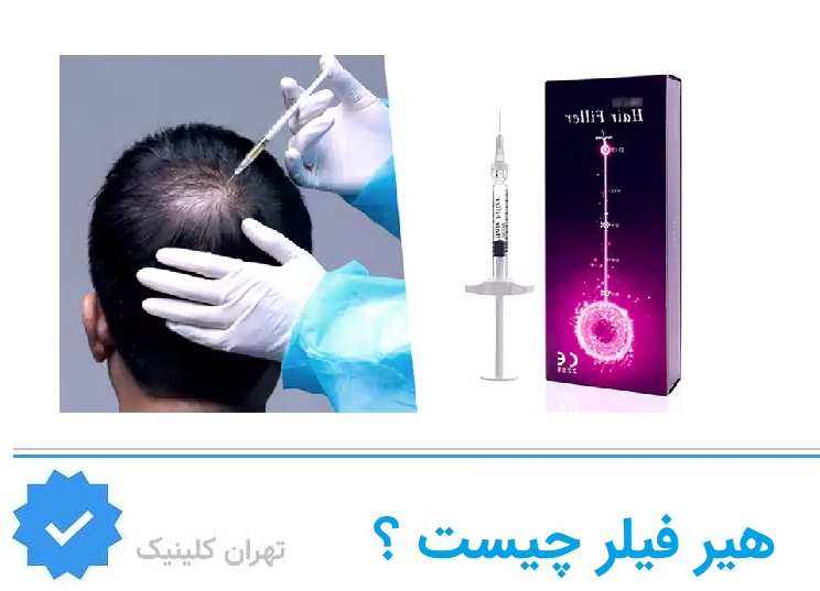 هیر فیلر چیست و چرا در شرق تهران پرطرفدار شده است؟