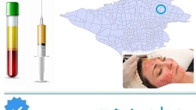 پی ار پی در هروی