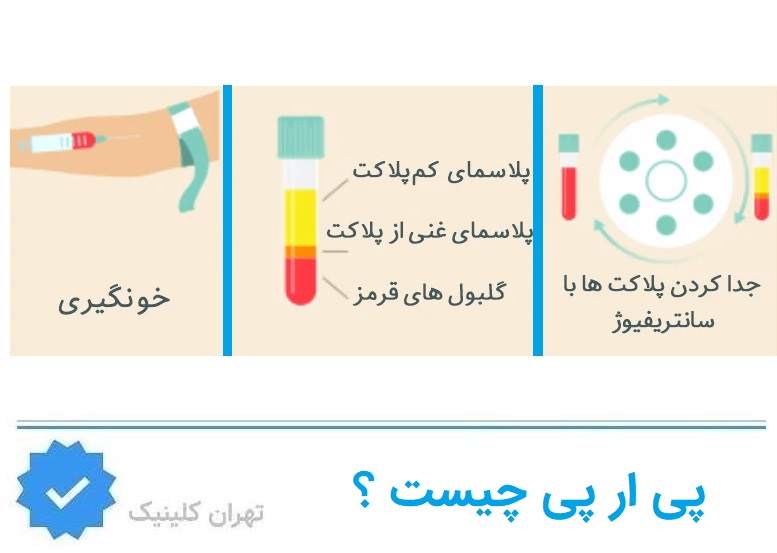 پی آر پی دقیقاً چیست و چگونه عمل می‌کند؟