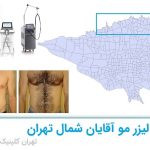 لیزر مو اقایان شمال تهران