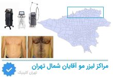 لیزر مو اقایان شمال تهران