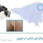 مراکز لیزر شاتی هروی