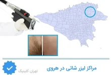 مراکز لیزر شاتی هروی