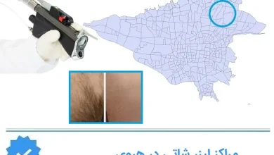 مراکز لیزر شاتی هروی