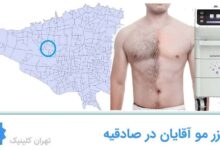 مراکز لیزر مو آقایان در صادقیه