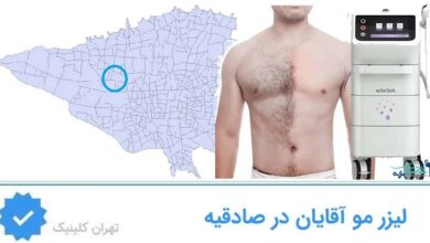 مراکز لیزر مو آقایان در صادقیه