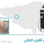 لیزر مو آقایان اکباتان