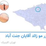 لیزر مو زائد اقایان جنت آباد