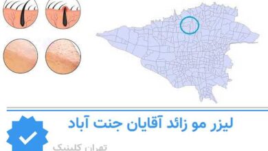 لیزر مو زائد اقایان جنت آباد