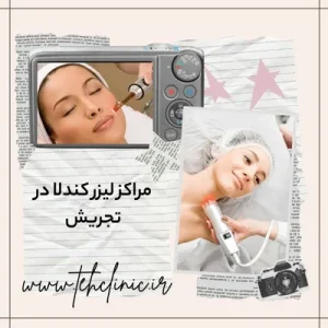مراکز لیزر کندلا در تجریش