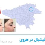 فیشیال در هروی