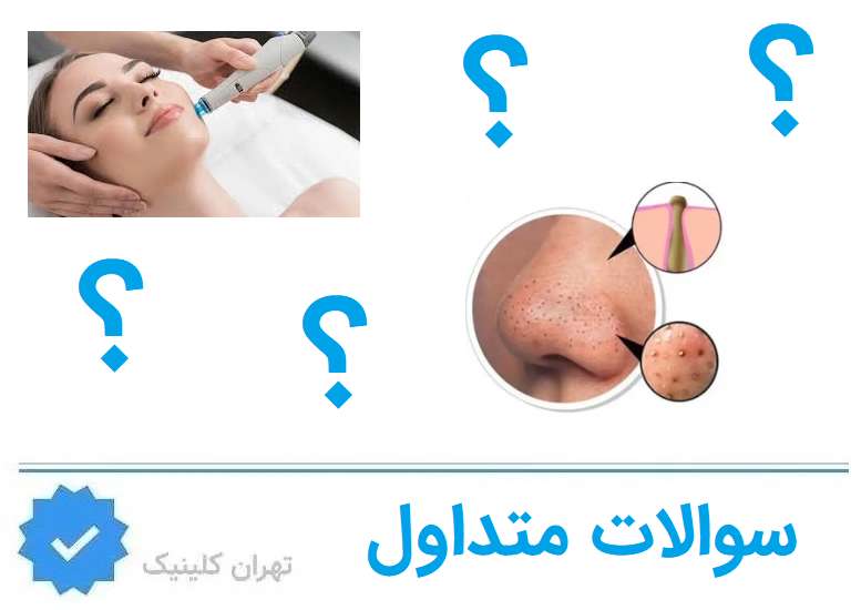 سوالات متداول درباره فیشیال در هروی تهران