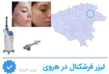 لیزر فرشکنال در هروی