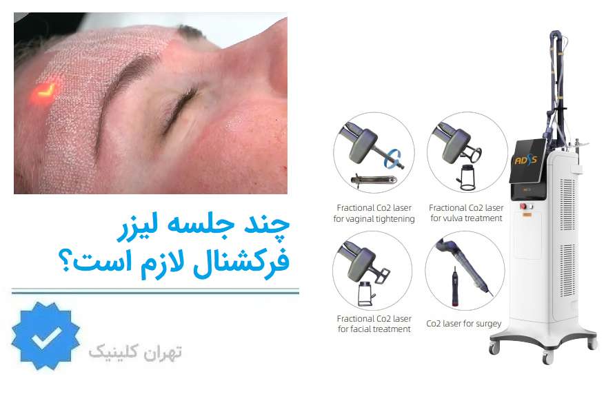 چند جلسه لیزر فرکشنال لازم است؟