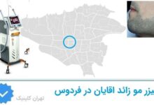 لیزر مو زائد اقایان فردوس