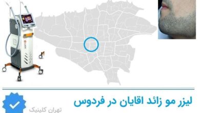 لیزر مو زائد اقایان فردوس