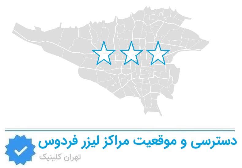 دسترسی و موقعیت مراکز لیزر فردوس