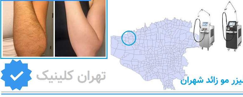لیزر مو زائد شهران