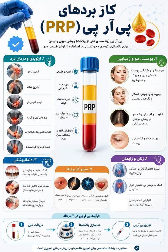 پی ار پی در فردوس 