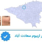 لیزر اربیوم سعادت اباد