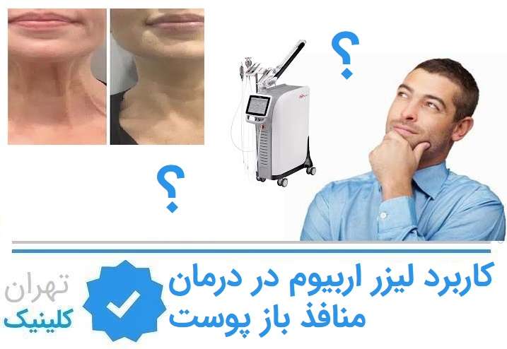 لیزر اربیوم برای جوانسازی صورت و گردن