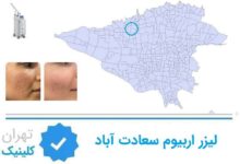 لیزر اربیوم سعادت اباد