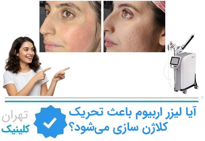آیا لیزر اربیوم باعث تحریک کلاژن سازی می‌شود؟