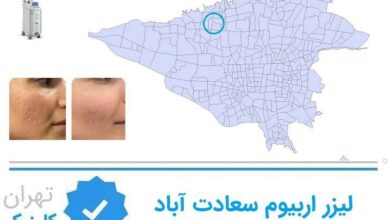 لیزر اربیوم سعادت اباد